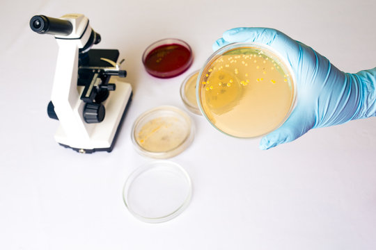 Medical laboratory testing for intestinal infection, E.coli bacterial infection in Petri dish