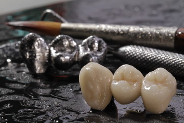Close-up E-max pressed ceramic bridge and metal crown with dentistry utensils