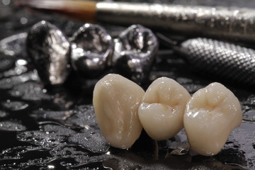 Macro E-max pressed ceramic bridge and metal crown with dentistry utensils