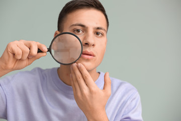 Fototapeta na wymiar Portrait of young man with acne problem and magnifier on grey background