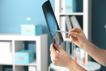 Young doctors studying X-ray image in clinic