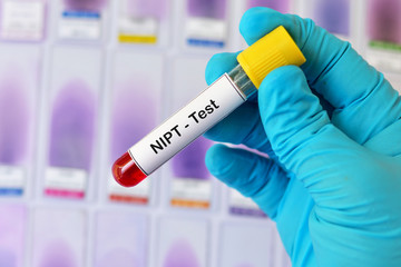 Blood sample for NIPT or Non Invasive Prenatal Testing, diagnosis for fetal Down syndrome in...