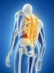 3d rendered medically accurate illustration of a man having back pain