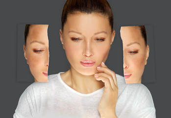 Dark spots, freckles,hyperpigmentation(melasma or chloasma)