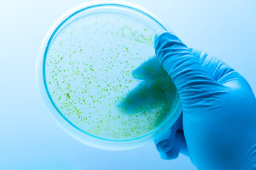 Colony of blue green algae in culture medium plate.