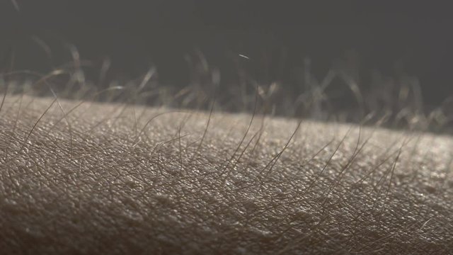 Goosebumps macro. Hair on the hand rise up. Skin reaction to cold, fear, or good music. Horripilation on skin.