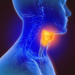 3d illustration of throat cancer