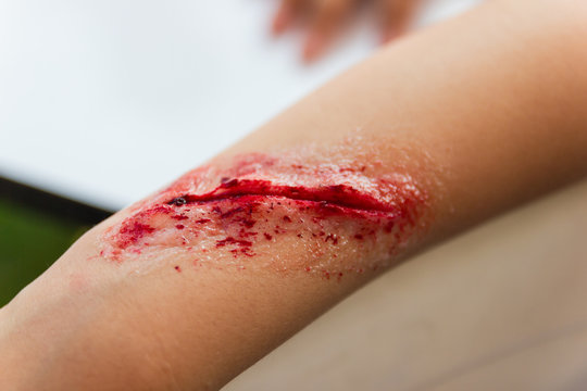 Fake wounds on the arms of children dress the wound special effect