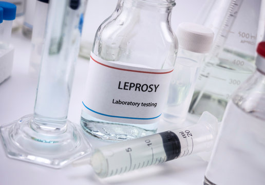 Test leprosy in laboratory, conceptual image, horizontal composition