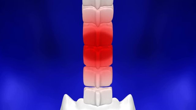 Lower back pain. Red blinking on the backbone. Loopable. Luma matte. 3D rendering.