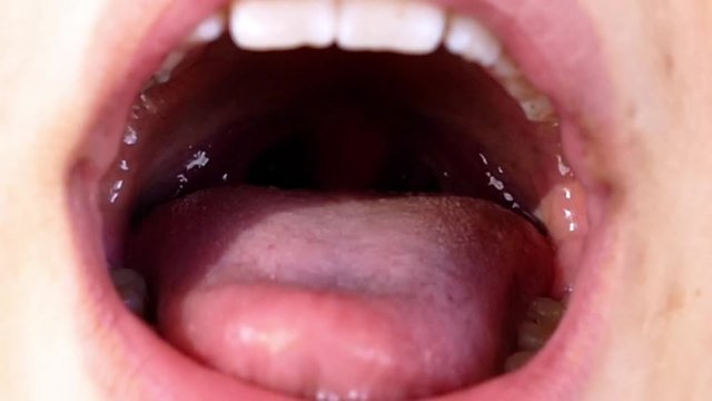 oral care and teeth, dental cleaning in children,