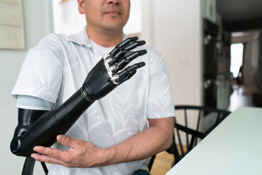Man touches elbow on his robotic arm