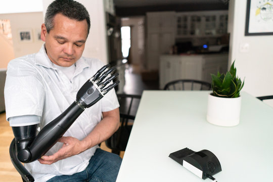 Man with charger for his robotic arm