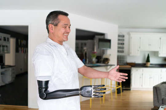 Smiling man with robotic arm