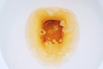 Closeup Urine or yellow pee and bubbles in white flush bowl toilet