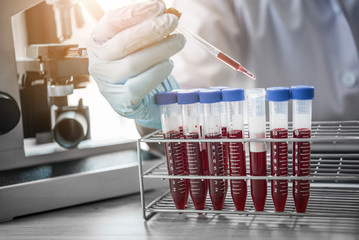 lab technician assistant analyzing a blood sample in test tube at laboratory. Medical,...