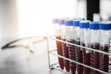 blood sample in test tube at laboratory. Medical, pharmaceutical and scientific research and...