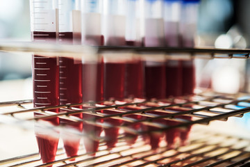 blood sample in test tube at laboratory. Medical, pharmaceutical and scientific research and development concept.