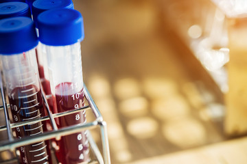 blood sample in test tube at laboratory. Medical, pharmaceutical and scientific research and development concept.