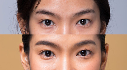 Asian Woman before applying make up hair style. no retouch, fresh face with acne, lips, eyes,...