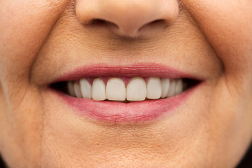 dental care and hygiene people concept - close up of senior woman smiling mouth and teeth
