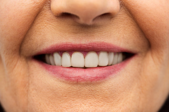 dental care and hygiene people concept - close up of senior woman smiling mouth and teeth