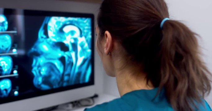 Professional female doctor neurologist working with brain MRI scans on a computer at her personal desk at hospital. 4K UHD