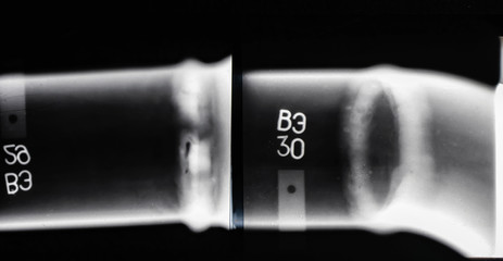 X-ray of a welded seam of the pipeline