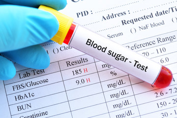 Abnormal blood sugar test results with blood sample tube