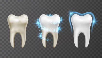 Deurstickers Tandarts Vectorillustratie van tandenbleekproces - reiniging en bescherming tegen vlekken en bacteriën