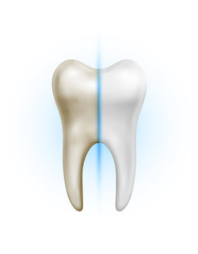 Vector dirty tooth and white clean healthy tooth comparison on white background
