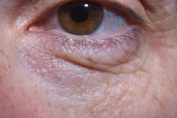 Fototapeta premium detail of eye bags and wrinkles of a middle-aged woman