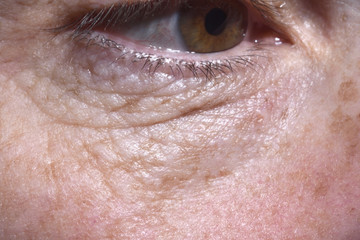 detail of eye bags and wrinkles of a middle-aged woman