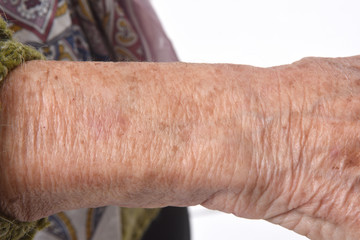 detail of the texture of a senior woman's skin