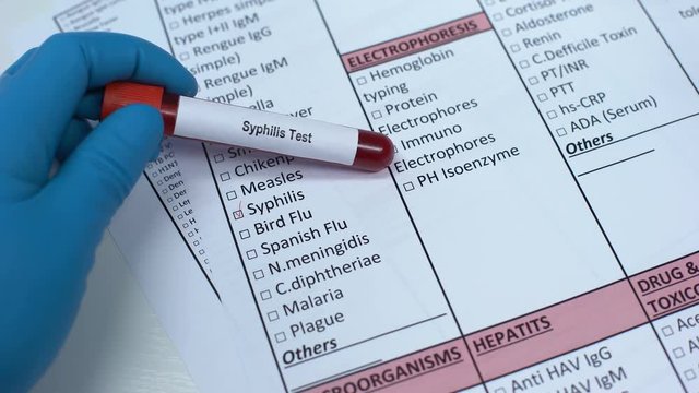 Syphilis, doctor checking disease in lab blank, showing blood sample in tube