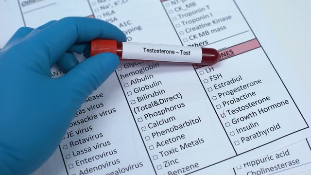 Testosterone, doctor checking hormone in lab blank, showing blood sample in tube