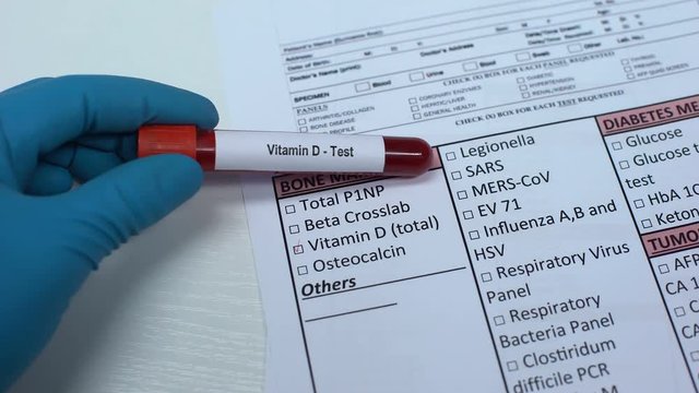 Vitamin D, doctor checking name in lab blank, showing blood sample in tube