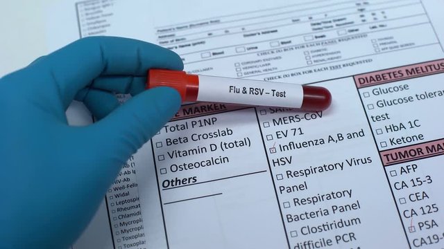 Flu and RSV, doctor checking disease in lab blank, showing blood sample in tube