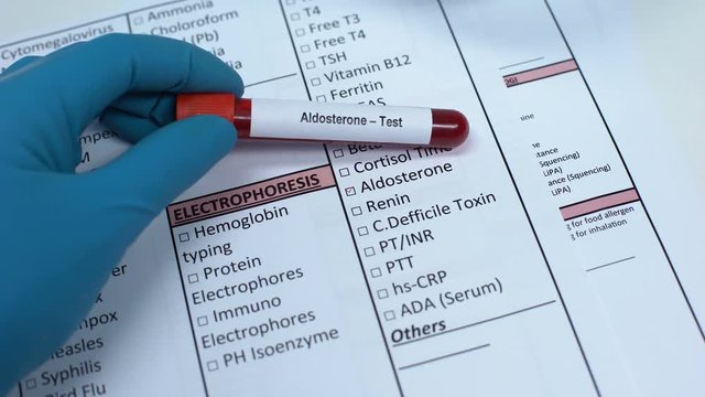 Aldosterone, doctor checking hormone in lab blank, showing blood sample in tube