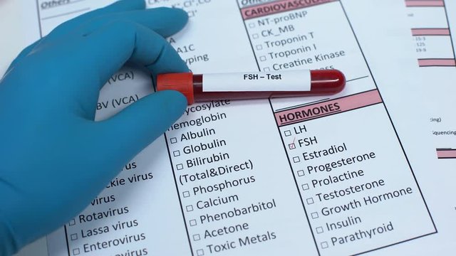FSH, doctor checking hormone name in lab blank, showing blood sample in tube
