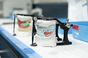 Partial Denture being manufactured in Dental Lab
