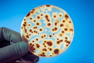 petri dish with microbe colony in doctor hand