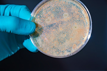 petri dish with microbe colony in doctor hand