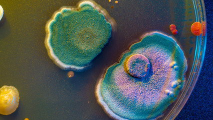 close up petri dish with microbe colony