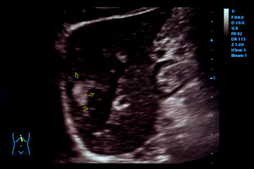 Fototapeta na wymiar Colourful image of modern ultrasound monitor