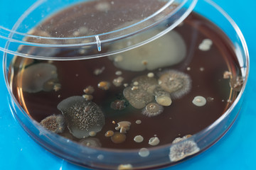 Petri dish with colonies of bacteria