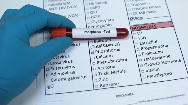 Phosphorus, doctor checking mineral in lab blank, showing blood sample in tube