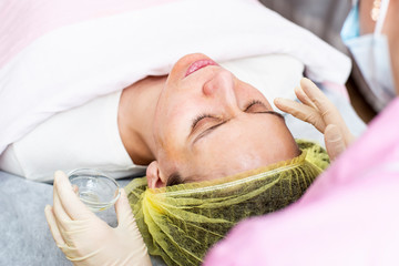 A professional cosmetologist applies a chemical peeling solution to the patient on the skin of the...