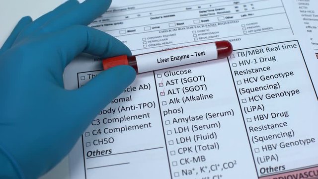 Liver enzyme, doctor checking name in lab blank, showing blood sample in tube