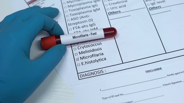 Microfilaria, doctor checking name in lab blank, showing blood sample in tube